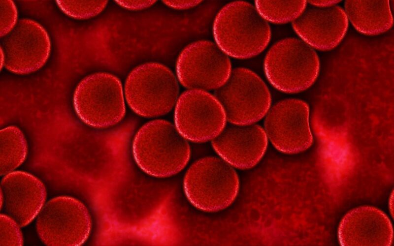 Talassemia, stop a trasfusioni frequenti e invasive