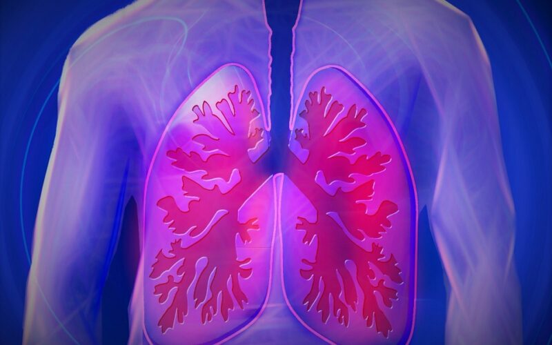 Sicilia, ogni anno 3 mila casi di tumore ai polmoni